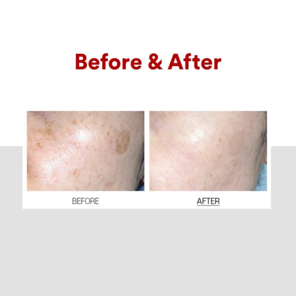 medipeel-melanon-x-cream-30ml-pic-3