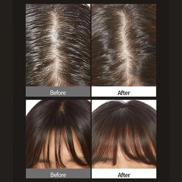 apieu-oily-hair-dry-powder-5g-pic-3