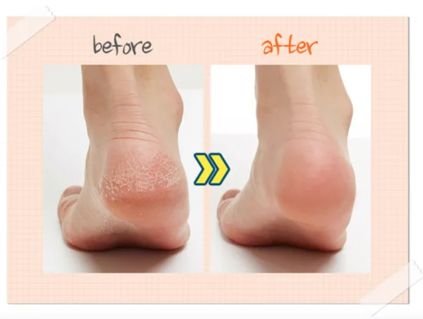 apieu-soft-foot-30-minute-peeling-socks-40ml-pic-2