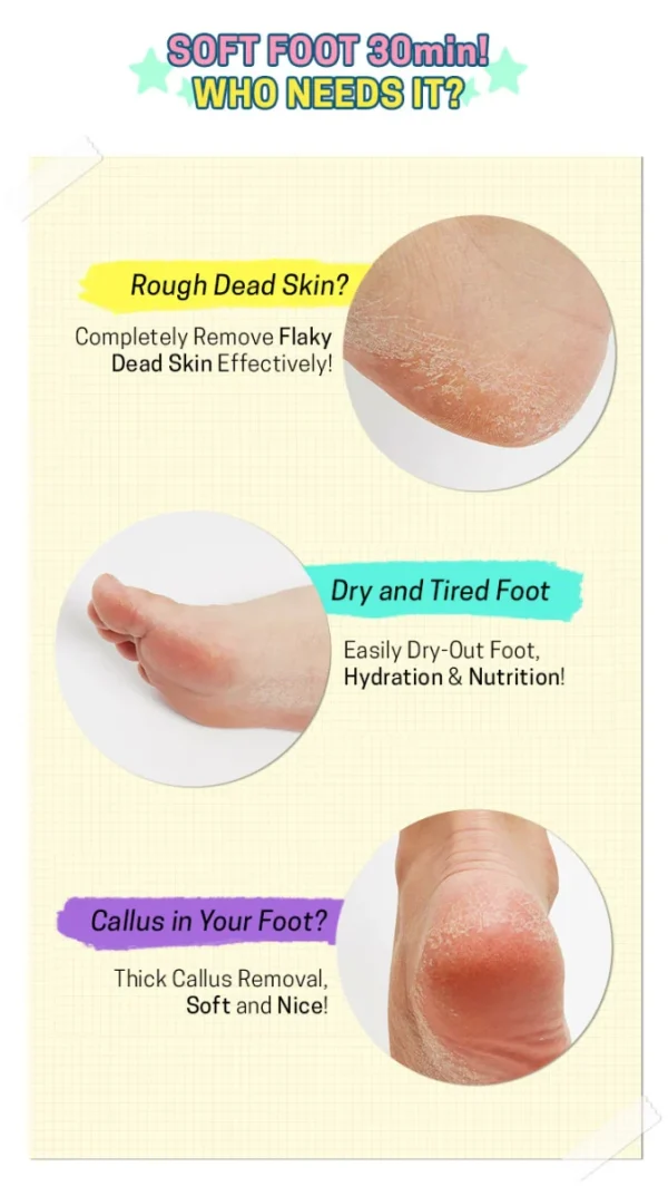 apieu-soft-foot-30-minute-peeling-socks-40ml-pic-3