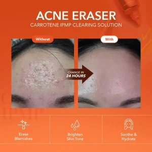 aprilskin-carrotene-ipmp-clearing-solution-20ml-pic-3
