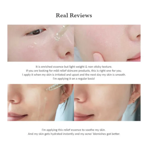 dr-althea-skin-relief-essence-30ml-pic-4