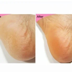 esfolio-3ha-foot-peeling-mask-20ml-pic-7