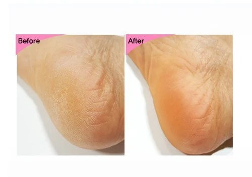 esfolio-3ha-foot-peeling-mask-20ml-pic-7