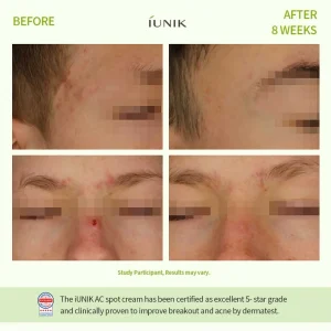 iunik-centella-calming-ac-spot-cream-20ml-pic-6