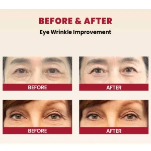 ksecret-seoul-1988-eye-cream-retinal-liposome-4percent-fermented-bean-30ml-pic-6