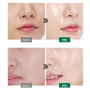 medipeel-peptide-9-volume-white-cica-essence-pro-100ml-pic-4