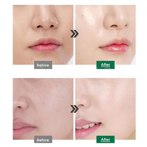 medipeel-peptide-9-volume-white-cica-essence-pro-100ml-pic-4