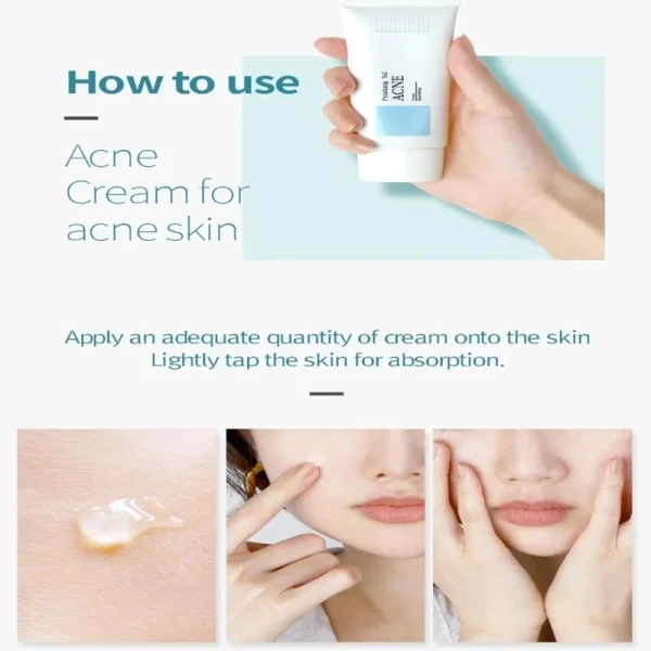 pyunkang-yul-acne-cream-50ml-pic-6