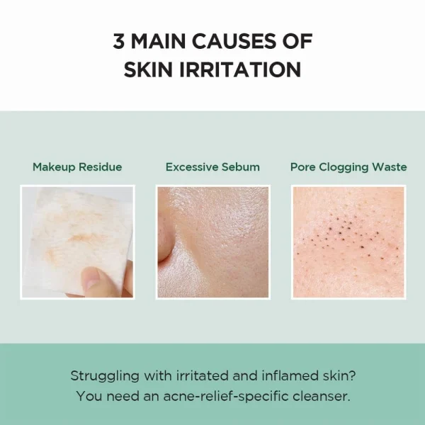 skin1004-madagascar-centella-tea-trica-bha-foam-125ml-pic-4