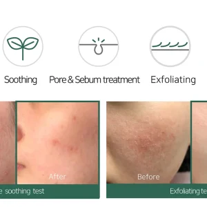 some-by-mi-aha-bha-pha-30-days-miracle-acne-clear-foam-100ml-pic-6
