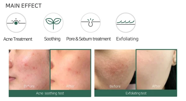 some-by-mi-aha-bha-pha-30-days-miracle-acne-clear-foam-100ml-pic-6