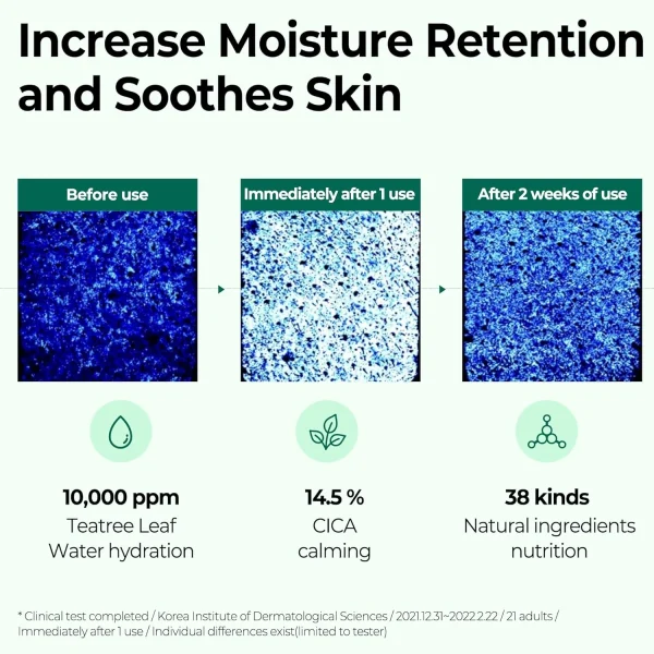 some-by-mi-aha-bha-pha-30-days-miracle-serum-50ml-pic-5