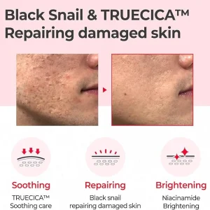 some-by-mi-snail-truecica-miracle-repair-toner-150ml-pic-4