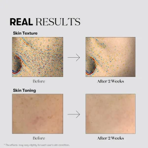 vt-cosmetics-tx-toning-essence-1000-shot-30ml-pic-4