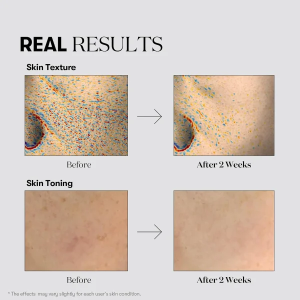vt-cosmetics-tx-toning-essence-1000-shot-30ml-pic-4