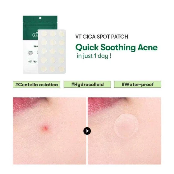 vt-cosmetics-vt-spot-patch-48pcs-pic-5
