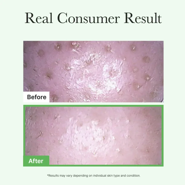 arencia-pore-melt-mochi-cleansing-oil-200ml-pic-8