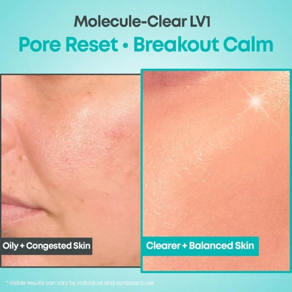 nine-less-molecule-clear-salicylic-acid-serum-30ml-pic-4
