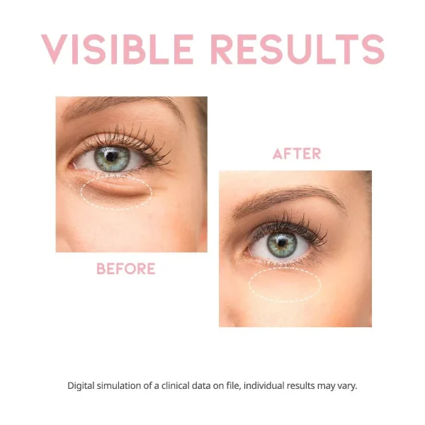 ootd-depuff-eye-serum-30g-pic-4