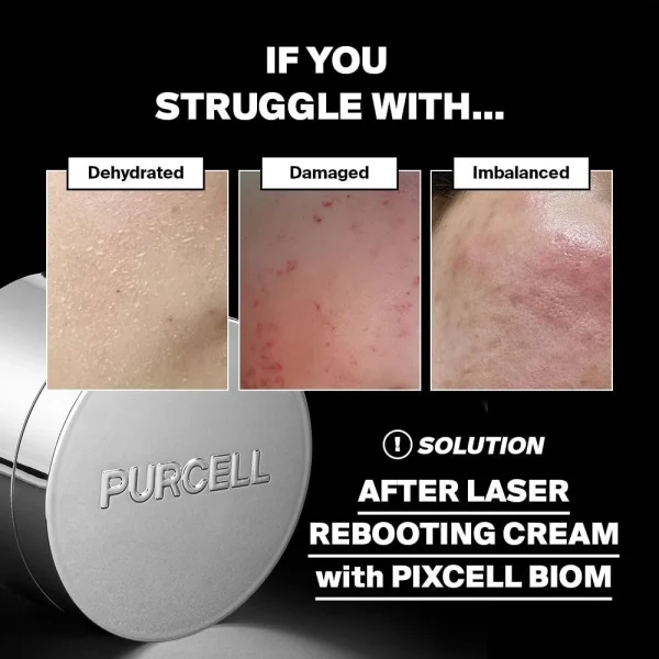 purcell-pixcell-biom-after-rebooting-cream-50ml-pic-2