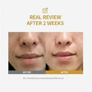 sungboon-editor-silk-peptide-intensive-lifting-ampoule-35ml-pic-6