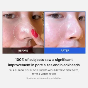 medicube-zero-pore-pad-20-70pads-pic-4