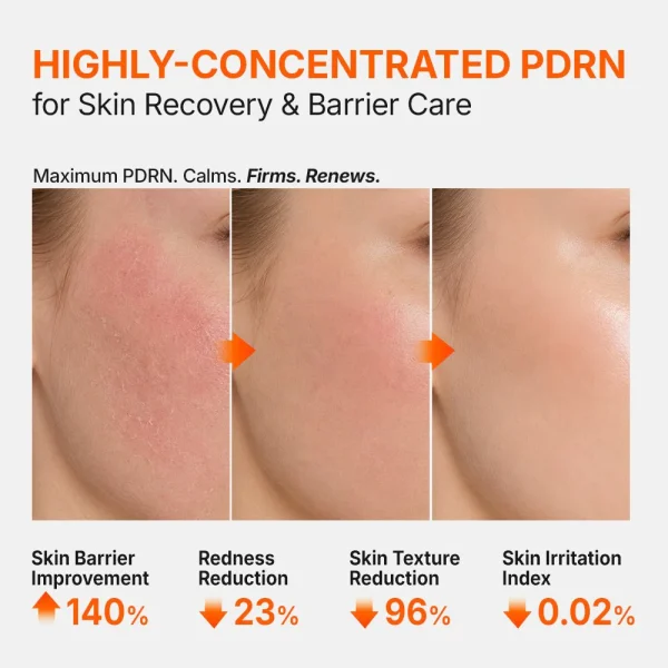 genabelle-pdrn-3percent-hyper-boost-ampoule-40ml-pic-2