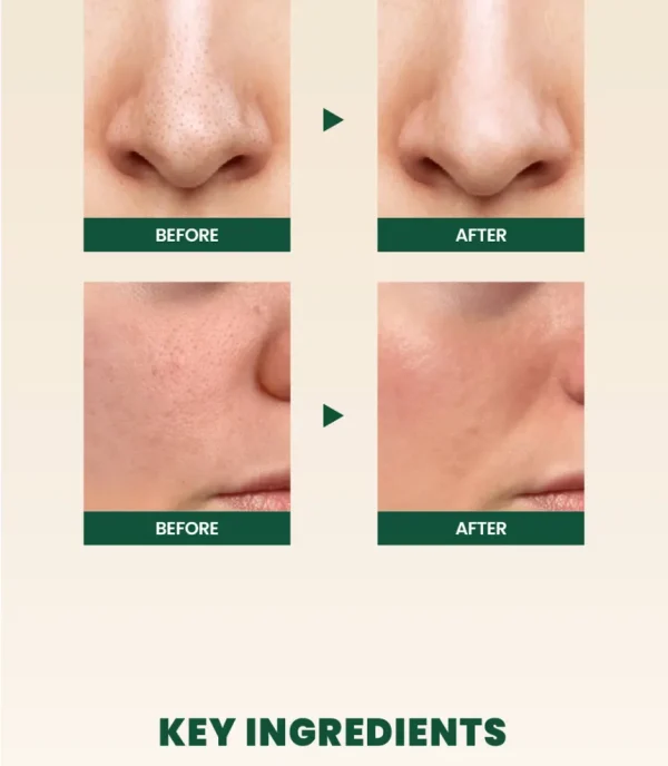 ksecret-seoul-1988-cleansing-foam-pine-cica-1percent-probiotics-mini-20ml-pic-2