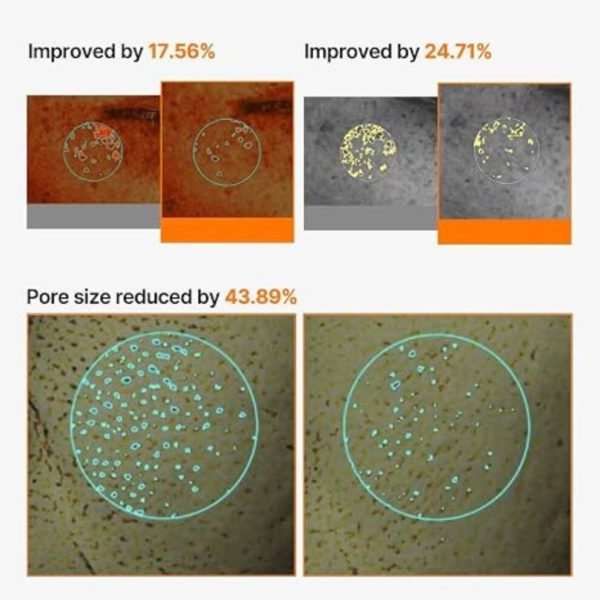 celimax-poredark-spot-brightening-cream-mask-20g-pic-7