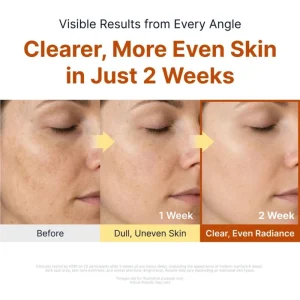 sungboon-editor-kojic-acid-niacinamide-brightening-ampoule-40ml-pic-4
