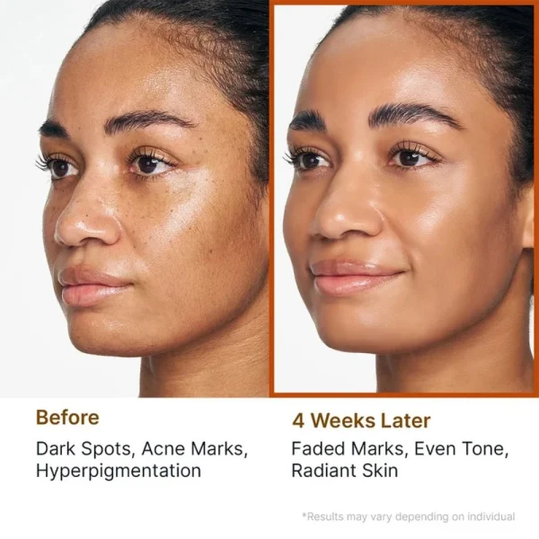 sungboon-editor-kojic-acid-niacinamide-radiance-soothing-gel-cleanser-120g-pic-3