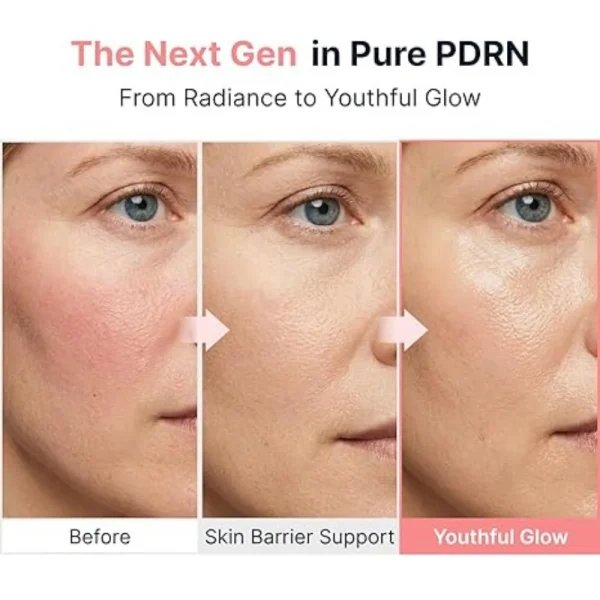 sungboon-editor-pdrn-pink-vitamin-glow-boosting-ampoule-40ml-pic-5