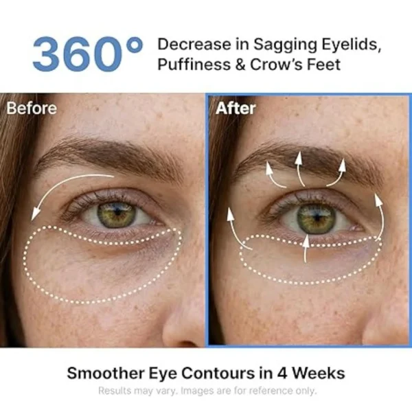 sungboon-editor-silk-peptide-egf-intensive-eye-cream-30ml-pic-5